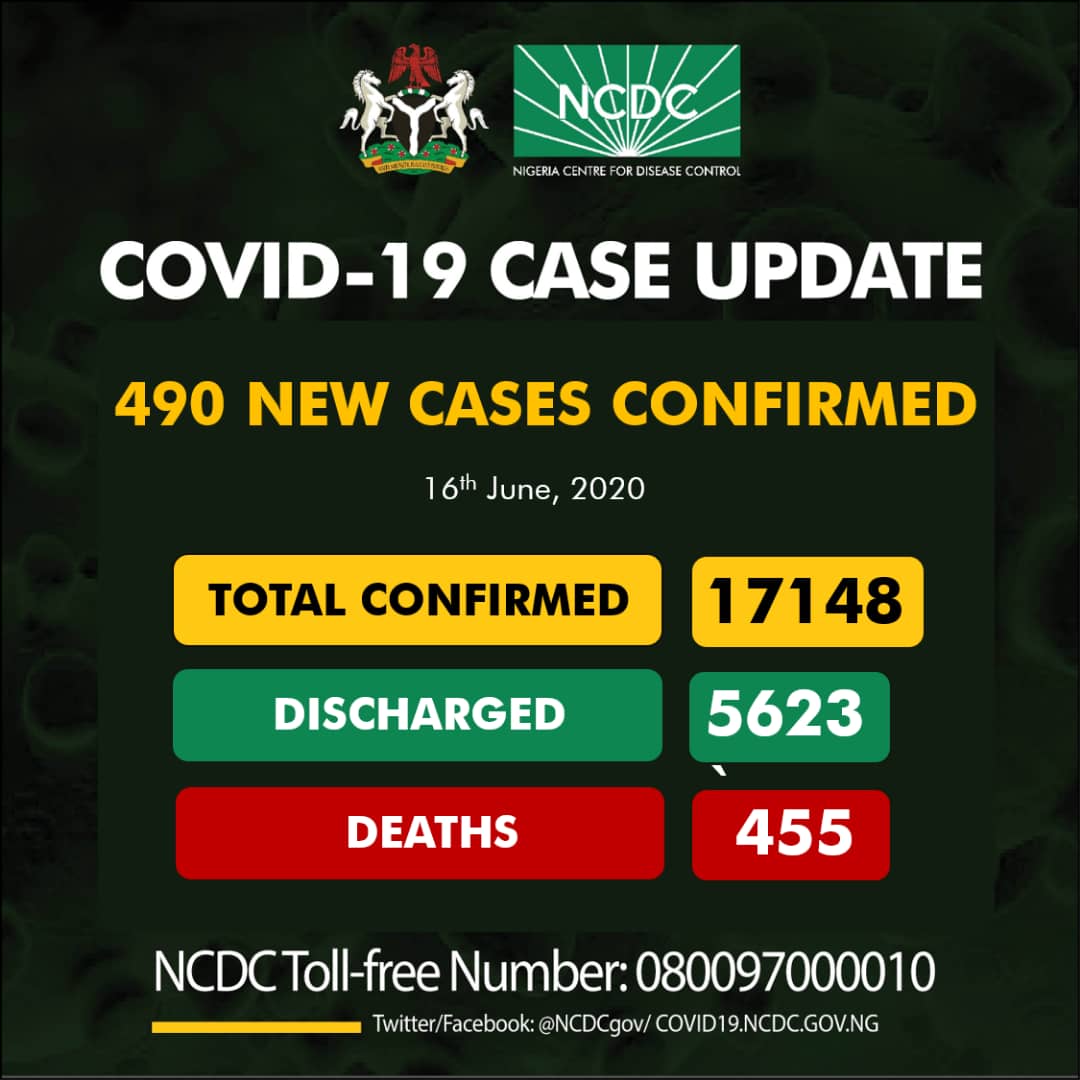 WHO welcomes preliminary results about dexamethasone use in treating critically ill COVID-19 patients