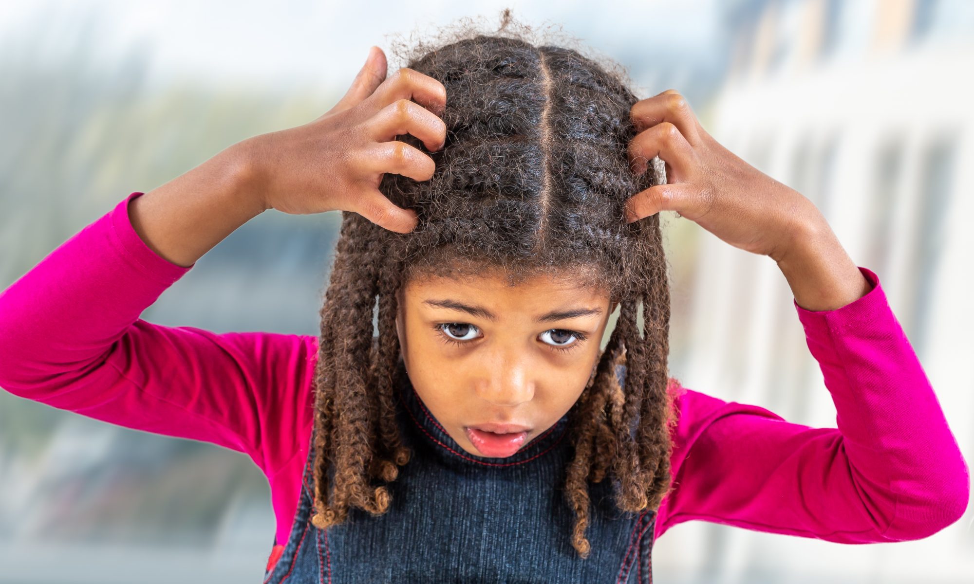 FDA Approves Ivermectin Lotion for Non-prescription Use to Treat Head Lice