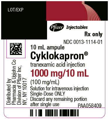 FDA Alerts Healthcare Professionals About the Risk of Medication Errors with Tranexamic Acid Injection Resulting in Inadvertent Intrathecal (Spinal) Injection