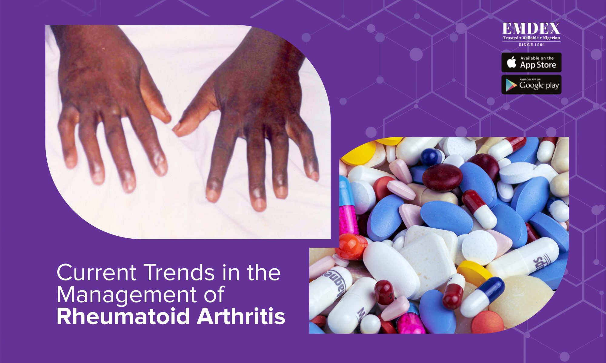 Current Trends in the Pharmacologic Management of Rheumatoid Arthritis